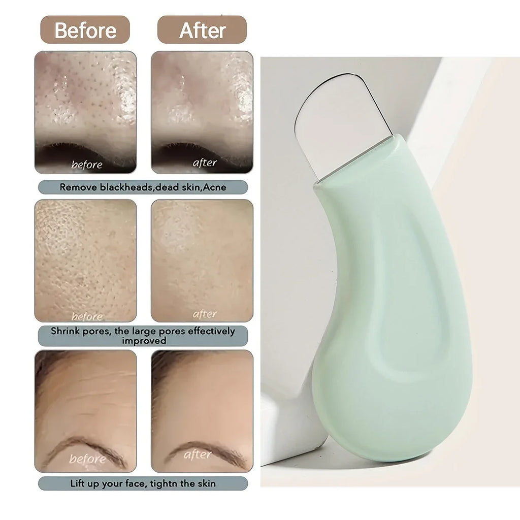 Grattoir Nettoyant Pores Silicone — Anti-Points Noirs Visage